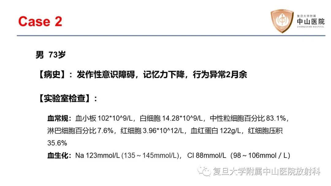 影像PPT - 【病例】边缘性脑炎—自身免疫性脑炎 VS 病毒性脑炎-4