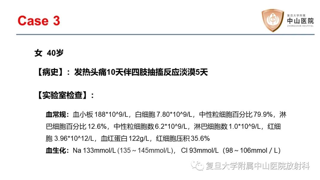 影像PPT - 【病例】边缘性脑炎—自身免疫性脑炎 VS 病毒性脑炎-6