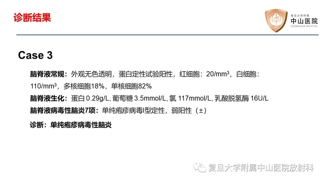 影像PPT - 【病例】边缘性脑炎—自身免疫性脑炎 VS 病毒性脑炎-10