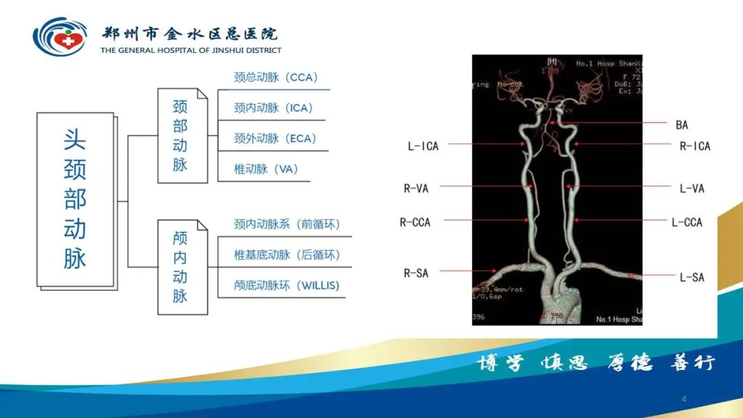 影像PPT - 【PPT】头颈CTA扫描技术与临床应用-4
