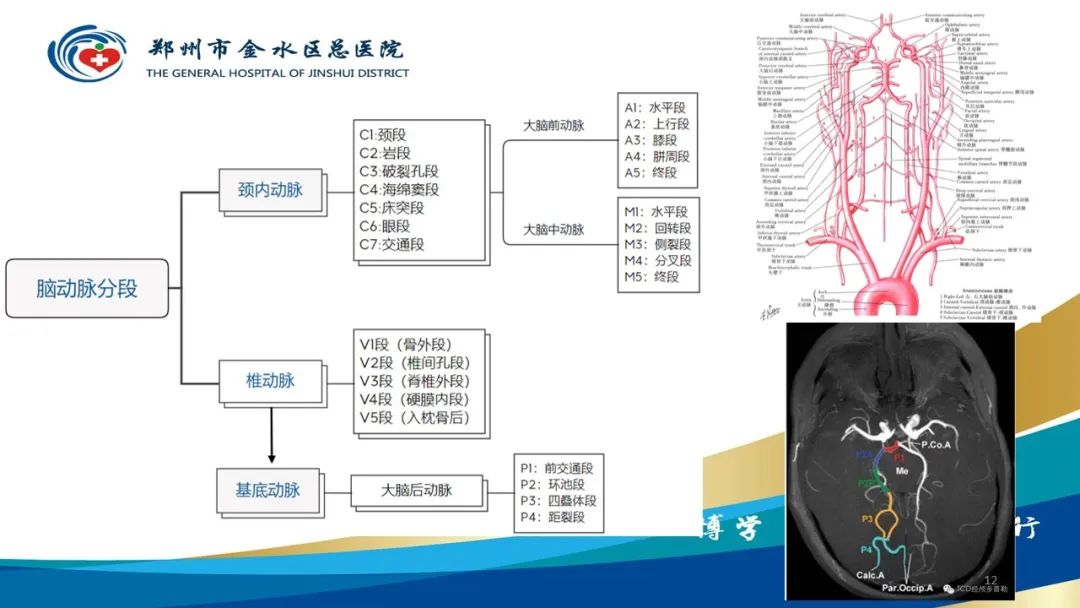影像PPT - 【PPT】头颈CTA扫描技术与临床应用-12