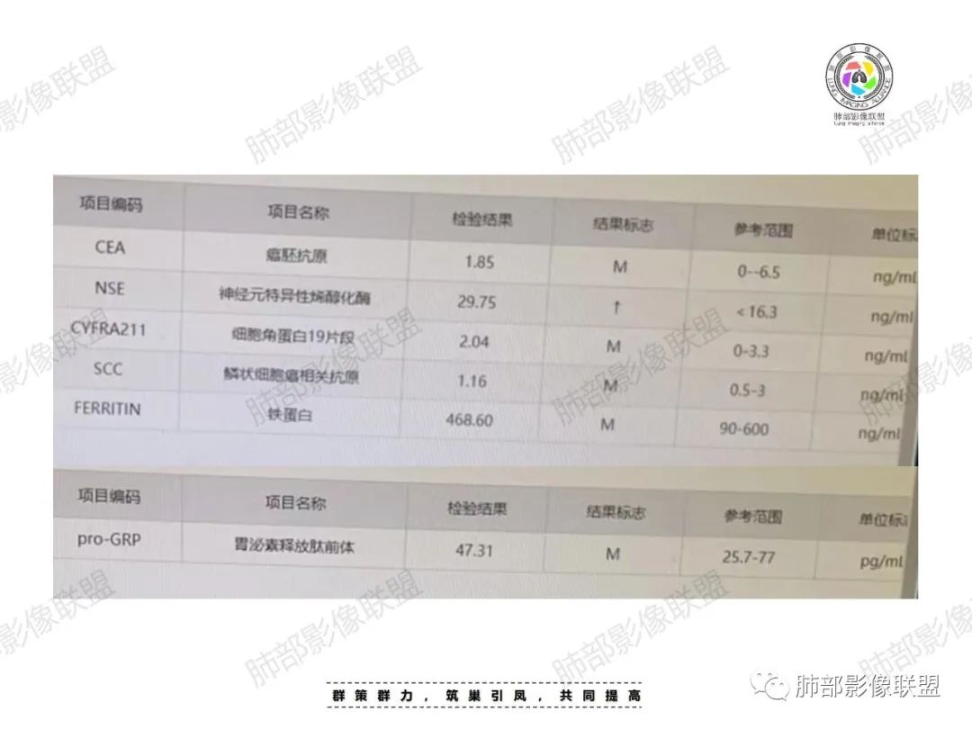 影像PPT - 【病例】肉芽肿性结节与腺癌的鉴别思路分析-4 影像PPT - 【病例】肉芽肿性结节与腺癌的鉴别思路分析-4