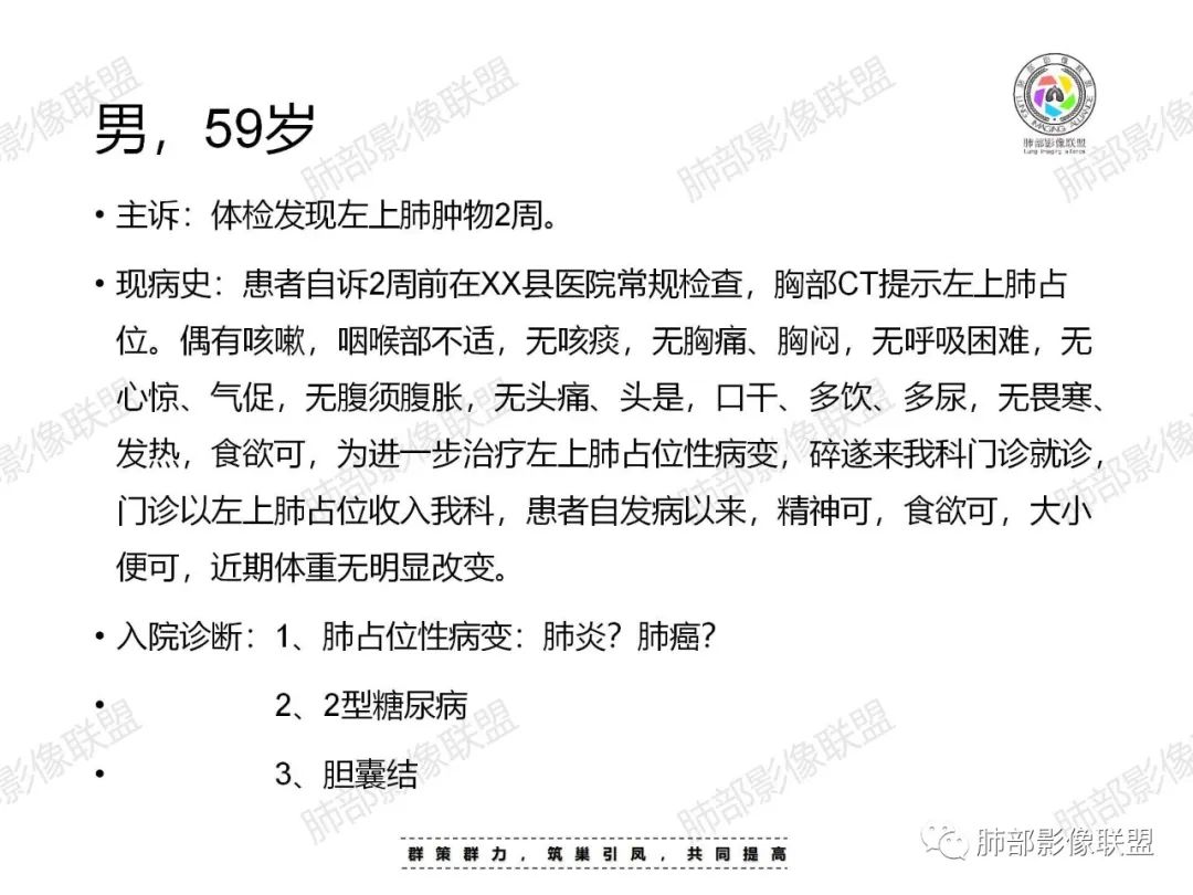 影像PPT - 【病例】肉芽肿性结节与腺癌的鉴别思路分析-2 影像PPT - 【病例】肉芽肿性结节与腺癌的鉴别思路分析-2