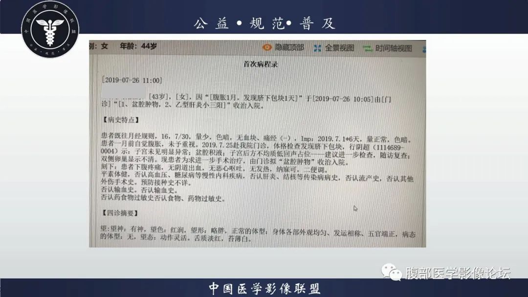 影像PPT - 【病例】卵巢子宫内膜样癌1例MR-2