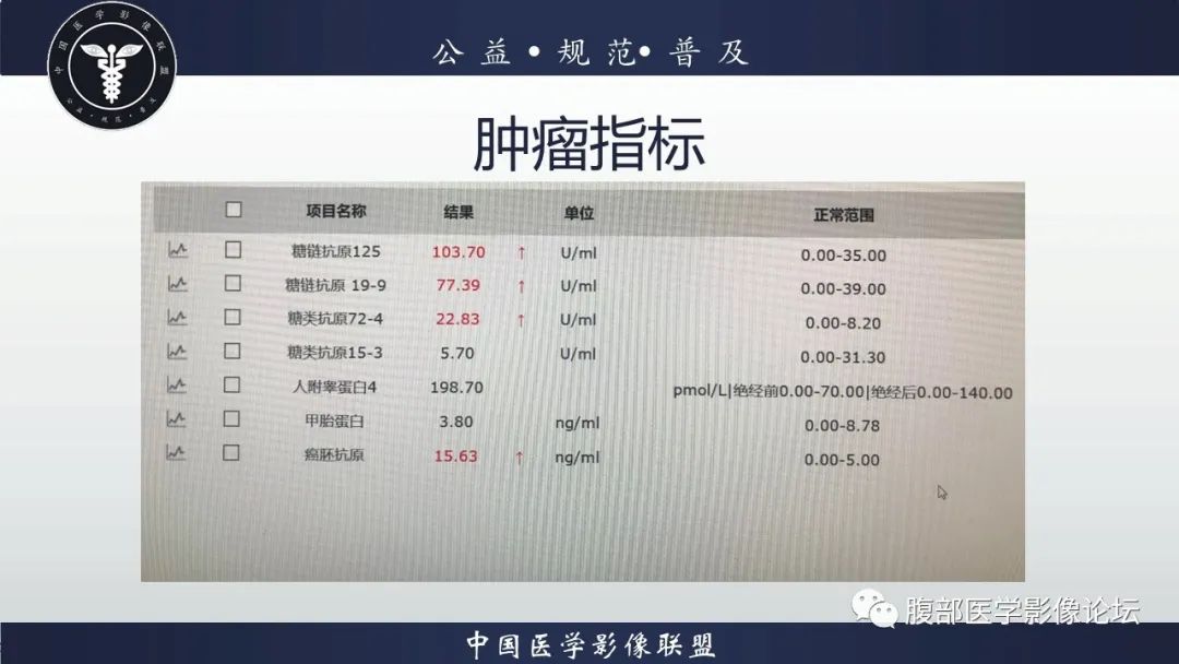影像PPT - 【病例】卵巢子宫内膜样癌1例MR-3