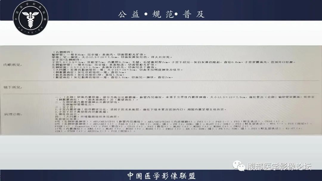 影像PPT - 【病例】卵巢子宫内膜样癌1例MR-12