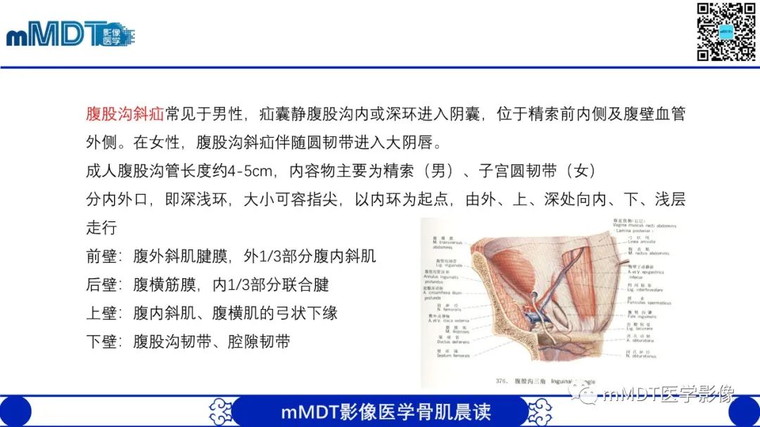 影像PPT - 【PPT】常见腹外疝的影像诊断（修正版）-4