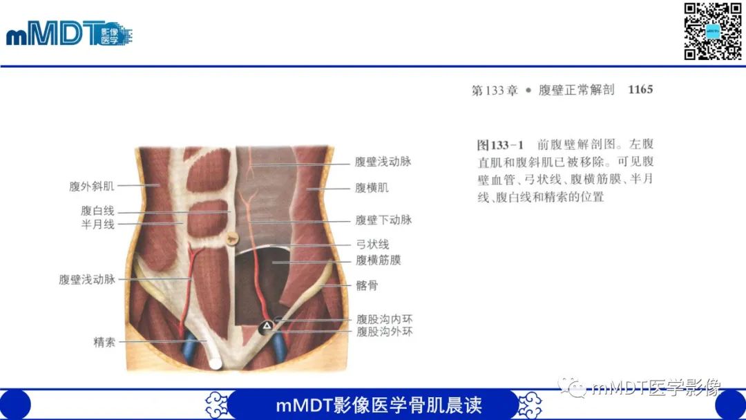 影像PPT - 【PPT】常见腹外疝的影像诊断（修正版）-5