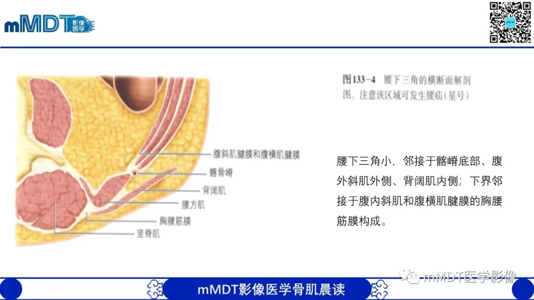 影像PPT - 【PPT】常见腹外疝的影像诊断（修正版）-25