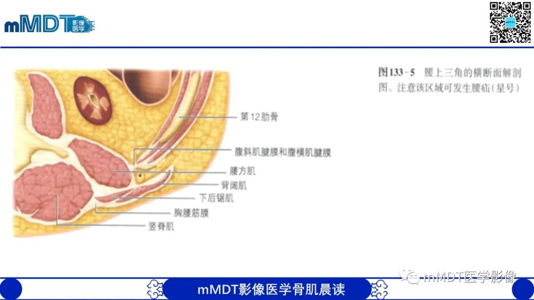 影像PPT - 【PPT】常见腹外疝的影像诊断（修正版）-26