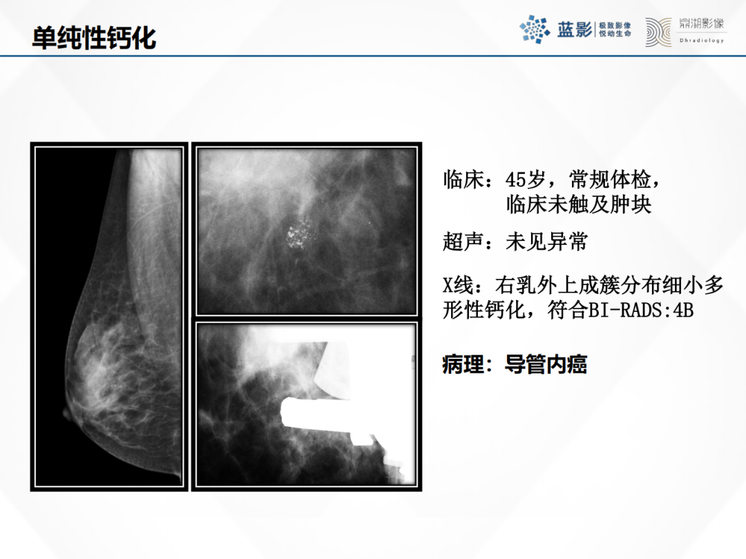 影像PPT - 【PPT】乳腺X线摄影在乳腺癌早筛早诊中的应用价值-5