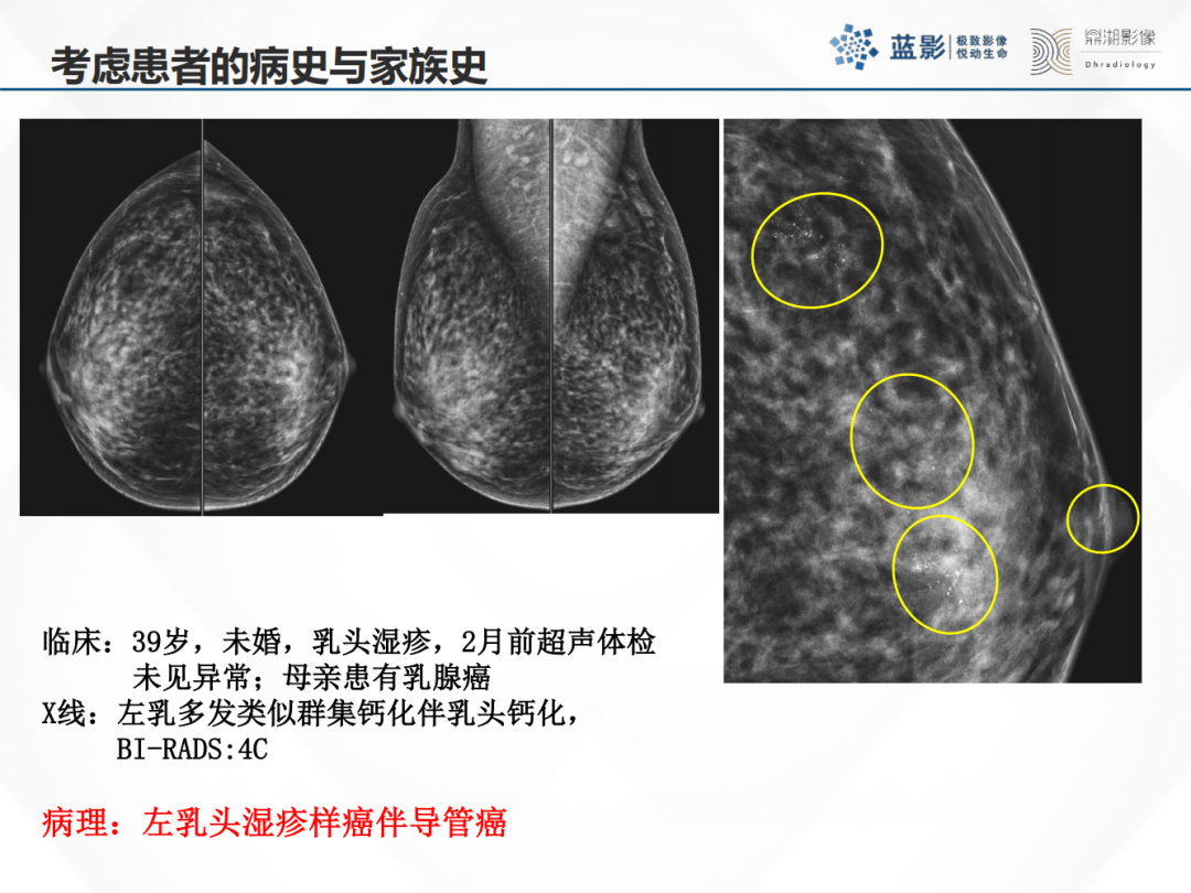 影像PPT - 【PPT】乳腺X线摄影在乳腺癌早筛早诊中的应用价值-27