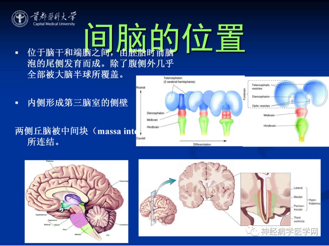 影像PPT - 【PPT】颅脑解剖—间脑-2