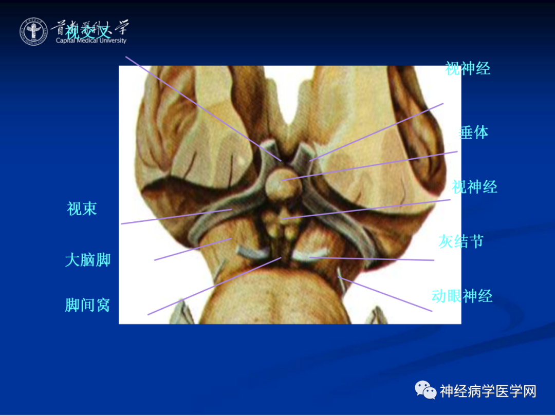 影像PPT - 【PPT】颅脑解剖—间脑-39