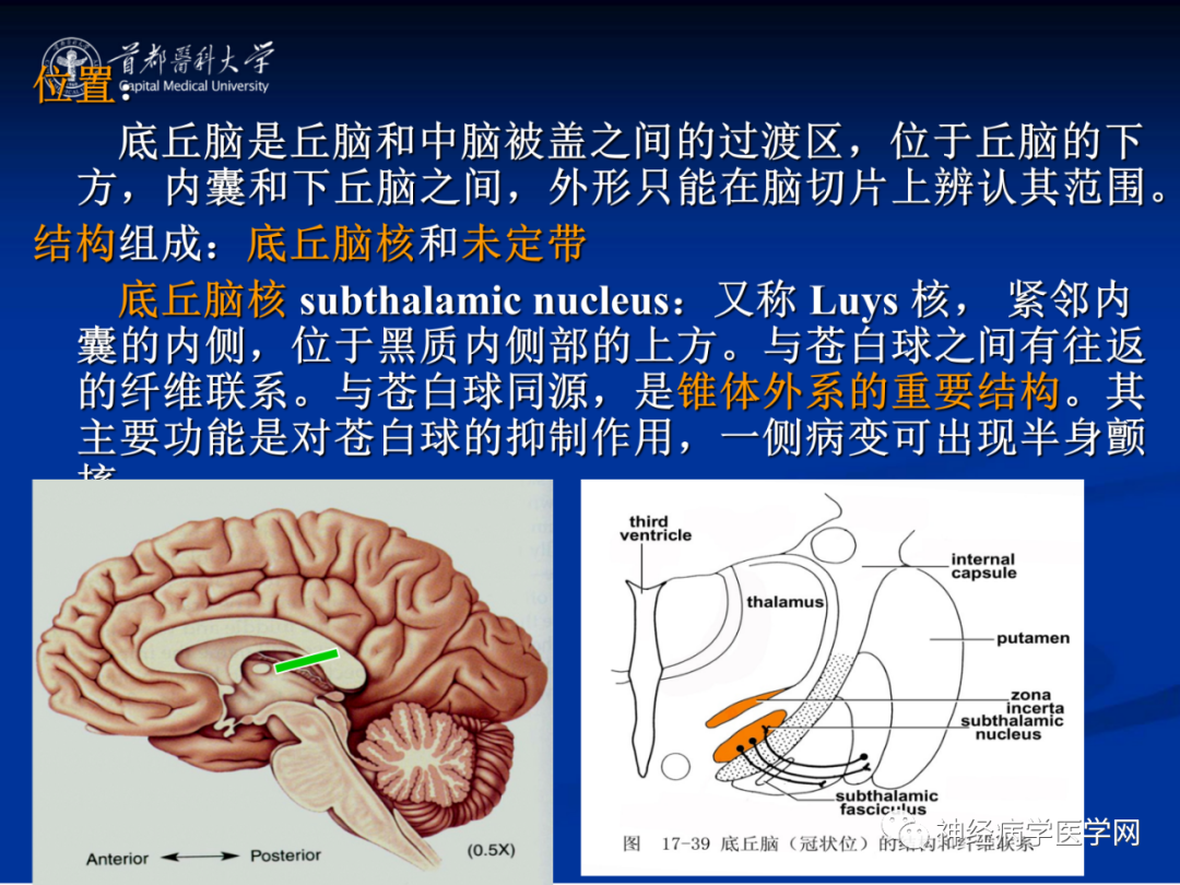 影像PPT - 【PPT】颅脑解剖—间脑-34