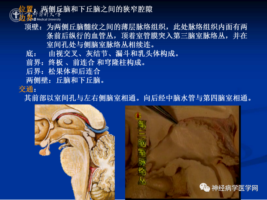 影像PPT - 【PPT】颅脑解剖—间脑-61
