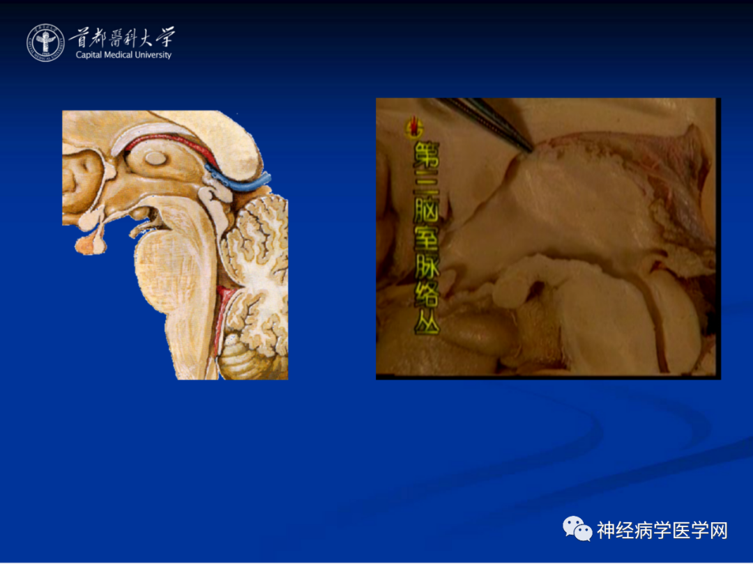 影像PPT - 【PPT】颅脑解剖—间脑-62