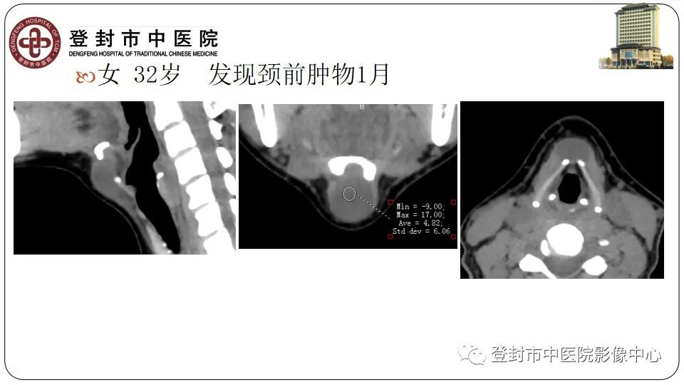 影像PPT - 【PPT】颈部先天性囊性病变-11