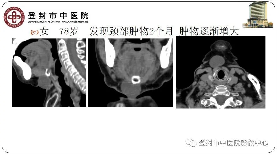 影像PPT - 【PPT】颈部先天性囊性病变-13
