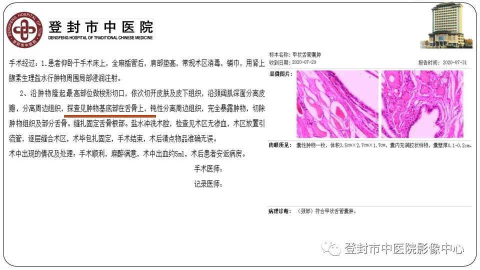 影像PPT - 【PPT】颈部先天性囊性病变-14