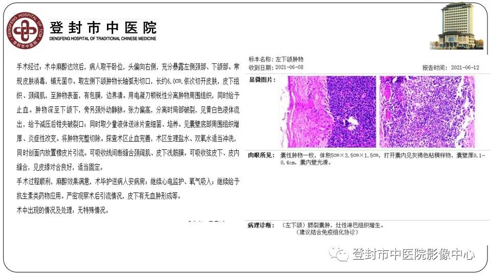 影像PPT - 【PPT】颈部先天性囊性病变-20