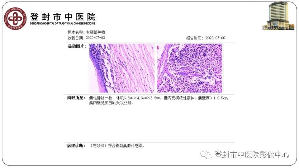 影像PPT - 【PPT】颈部先天性囊性病变-22