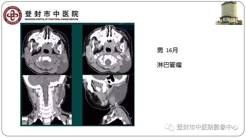 影像PPT - 【PPT】颈部先天性囊性病变-24