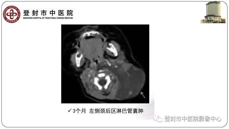 影像PPT - 【PPT】颈部先天性囊性病变-25