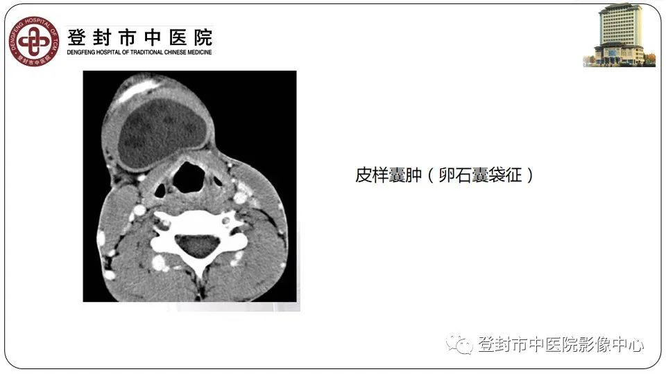 影像PPT - 【PPT】颈部先天性囊性病变-28