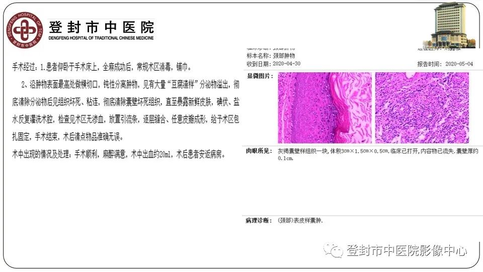 影像PPT - 【PPT】颈部先天性囊性病变-30