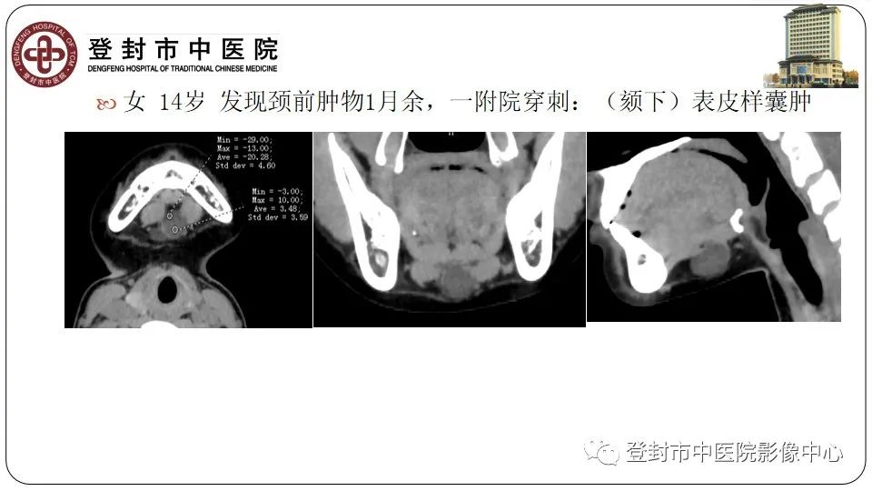 影像PPT - 【PPT】颈部先天性囊性病变-31