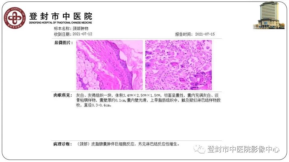 影像PPT - 【PPT】颈部先天性囊性病变-33