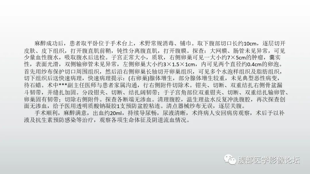 影像PPT - 【PPT】卵巢性索间质肿瘤—低分化Sertoli-Leydig细胞瘤1例MR影像-12 影像PPT - 【PPT】卵巢性索间质肿瘤—低分化Sertoli-Leydig细胞瘤1例MR影像-12