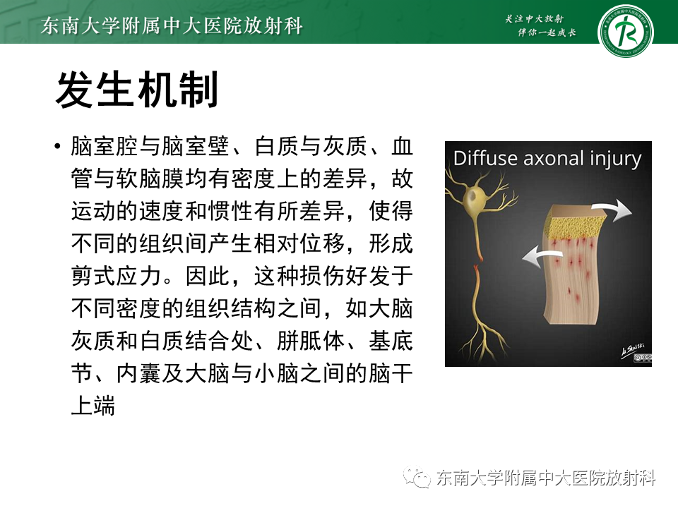 影像PPT - 【PPT】弥漫性轴索损伤-10