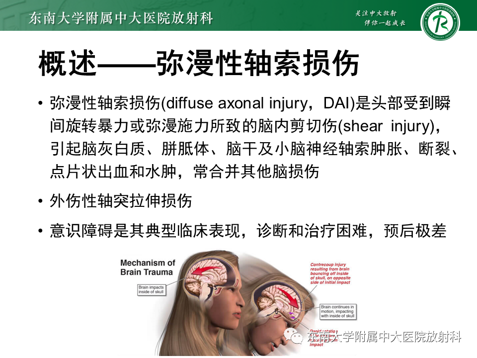 影像PPT - 【PPT】弥漫性轴索损伤-8
