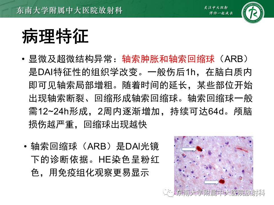 影像PPT - 【PPT】弥漫性轴索损伤-14