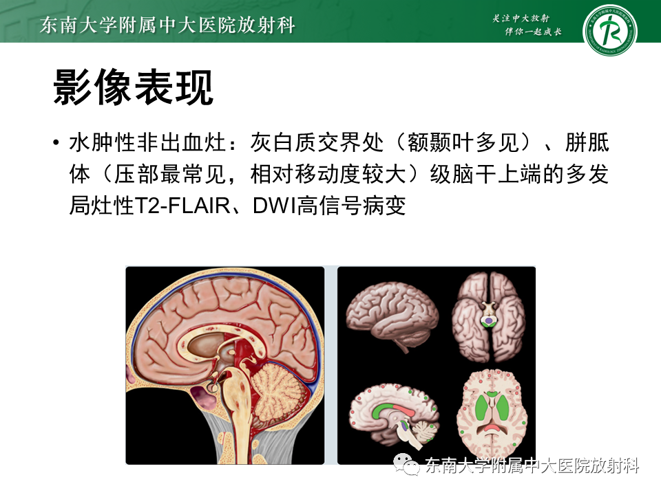 影像PPT - 【PPT】弥漫性轴索损伤-24