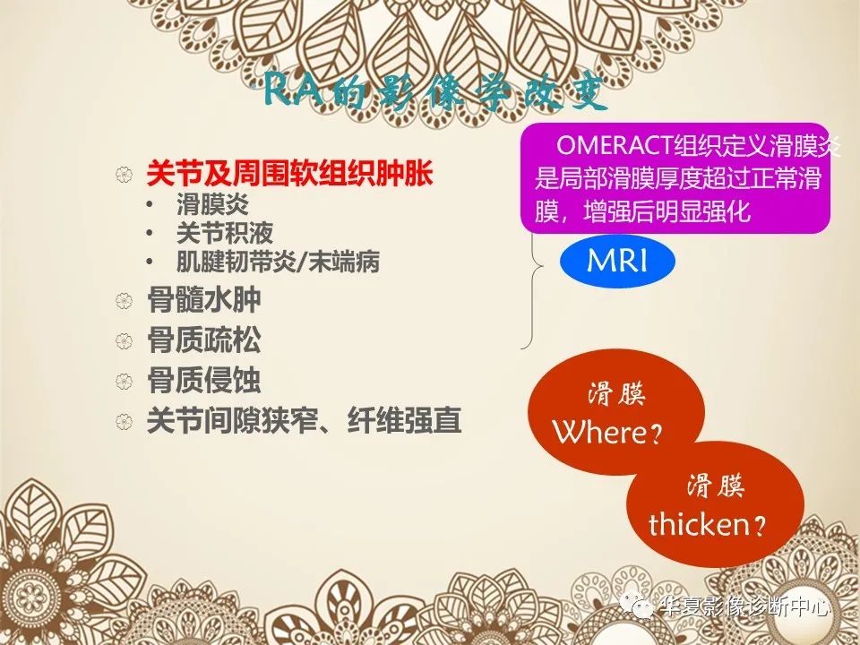 影像PPT - 【PPT】类风湿性关节炎的早期影像学诊断-9