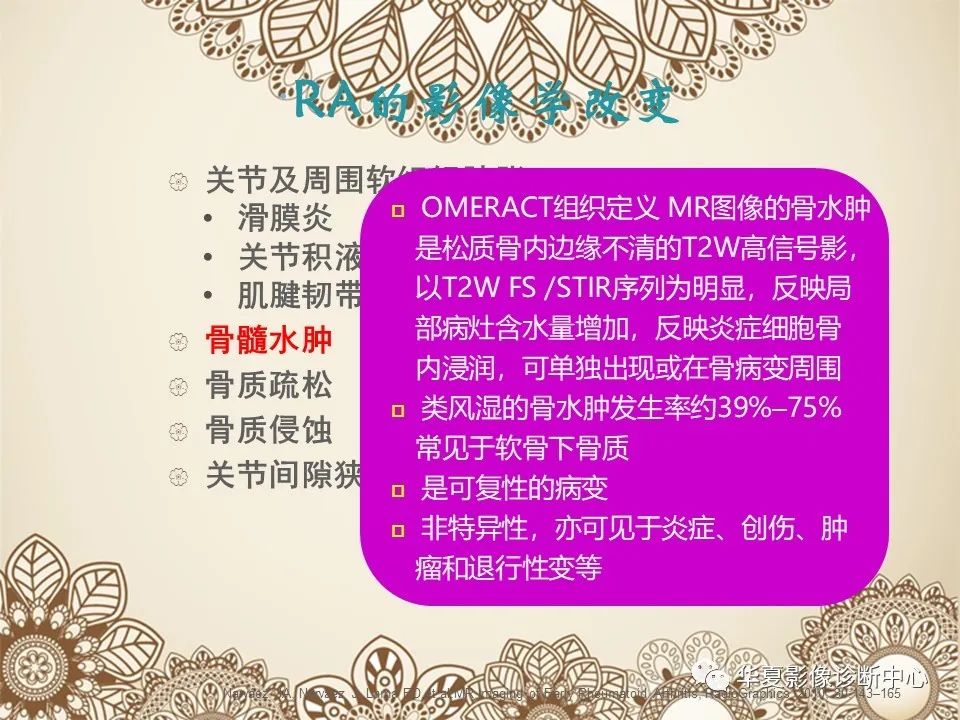 影像PPT - 【PPT】类风湿性关节炎的早期影像学诊断-16