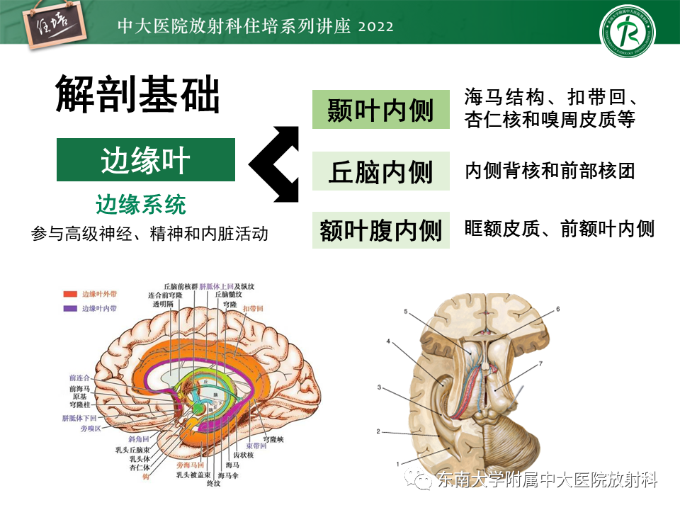 影像PPT - 【PPT】边缘系统受累疾病影像诊断与鉴别-2