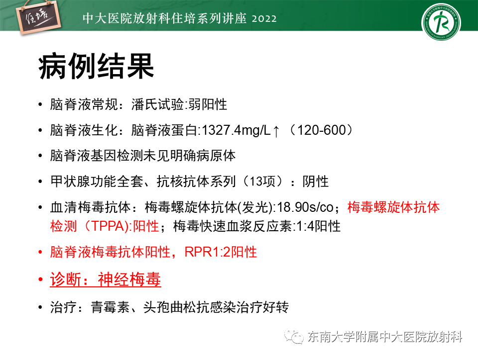 影像PPT - 【PPT】边缘系统受累疾病影像诊断与鉴别-15