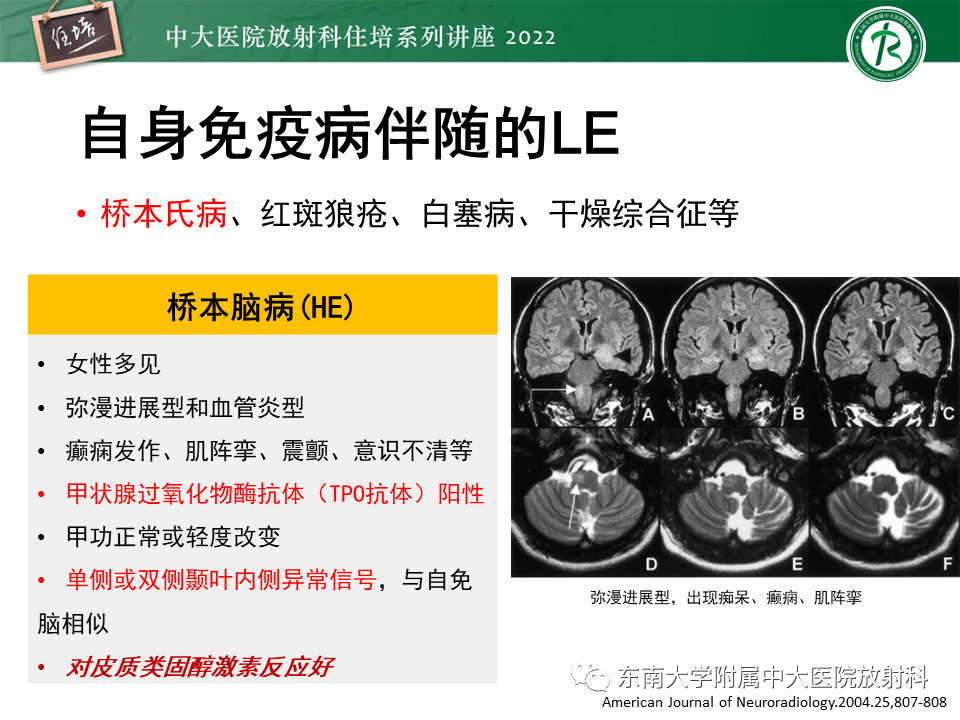 影像PPT - 【PPT】边缘系统受累疾病影像诊断与鉴别-29