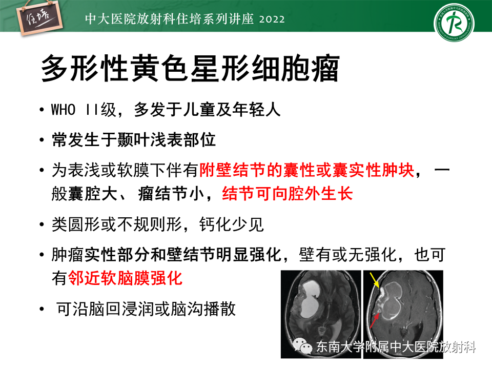 影像PPT - 【PPT】边缘系统受累疾病影像诊断与鉴别-34