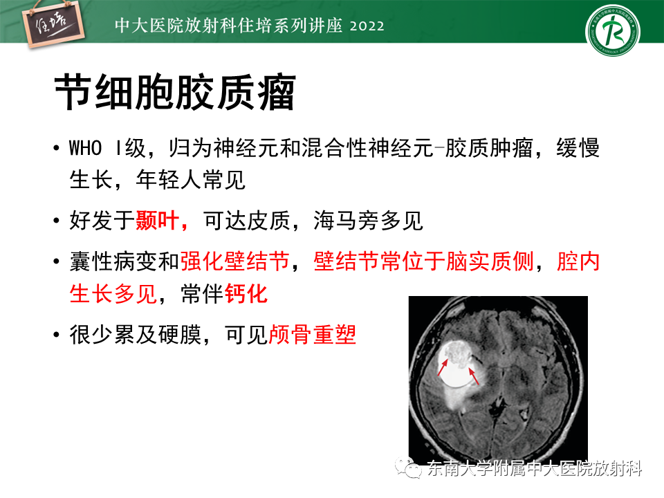 影像PPT - 【PPT】边缘系统受累疾病影像诊断与鉴别-33