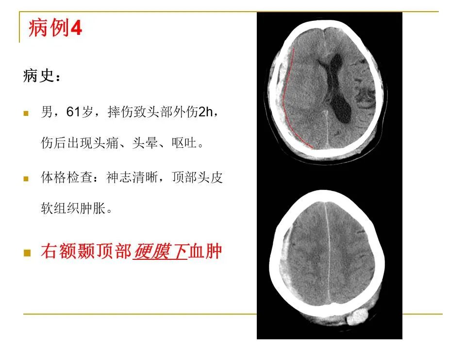 影像PPT - 【PPT】临床专业住院医师结业技能考核-10