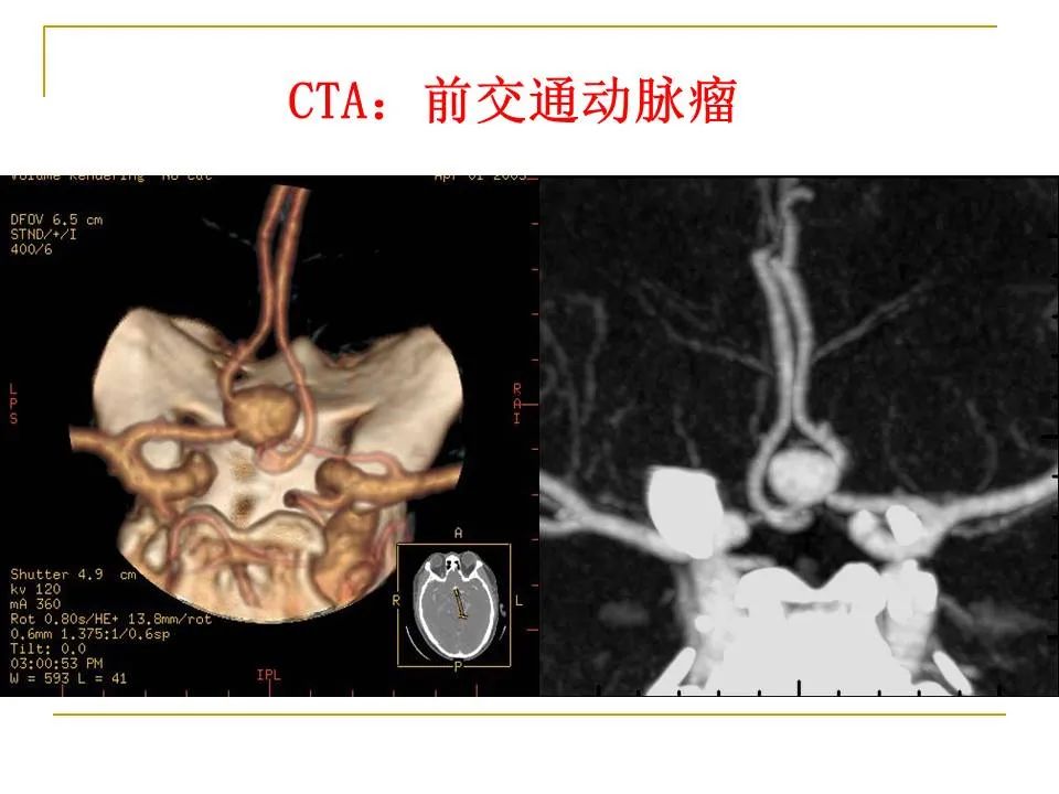 影像PPT - 【PPT】临床专业住院医师结业技能考核-8