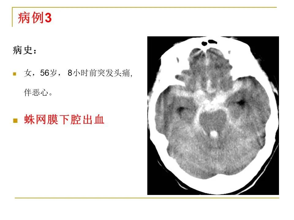 影像PPT - 【PPT】临床专业住院医师结业技能考核-7