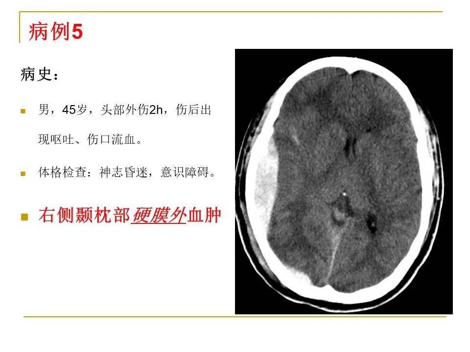 影像PPT - 【PPT】临床专业住院医师结业技能考核-11