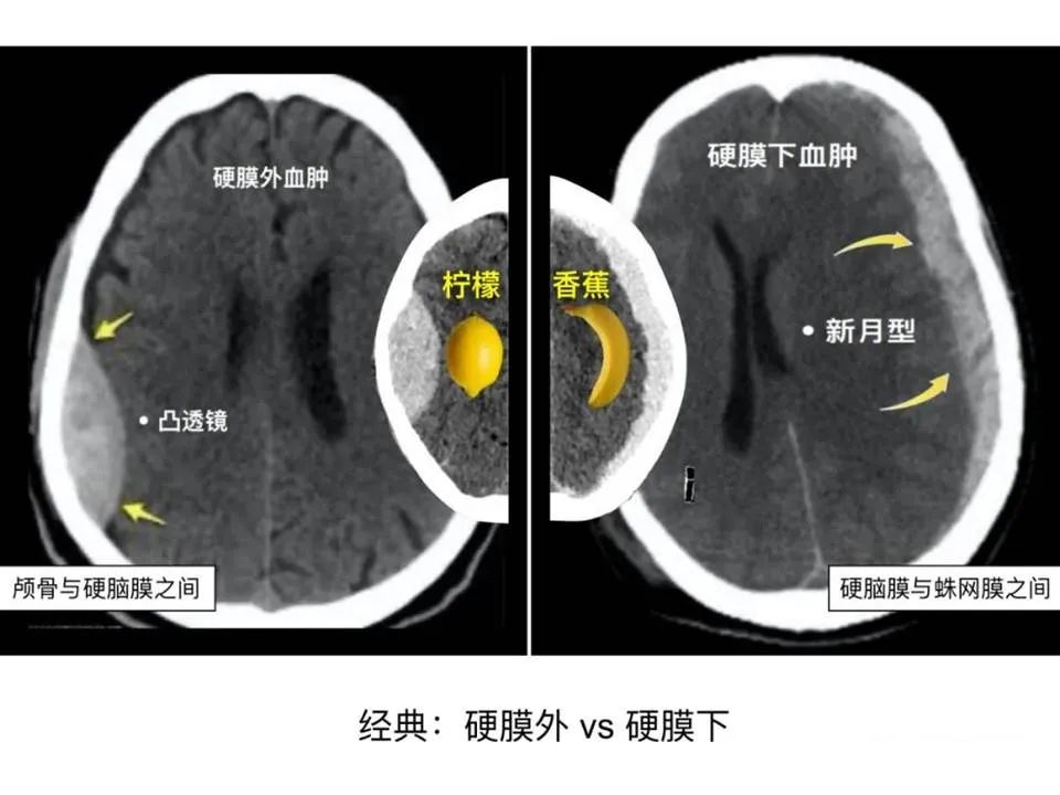影像PPT - 【PPT】临床专业住院医师结业技能考核-12