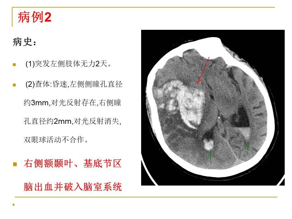 影像PPT - 【PPT】临床专业住院医师结业技能考核-6